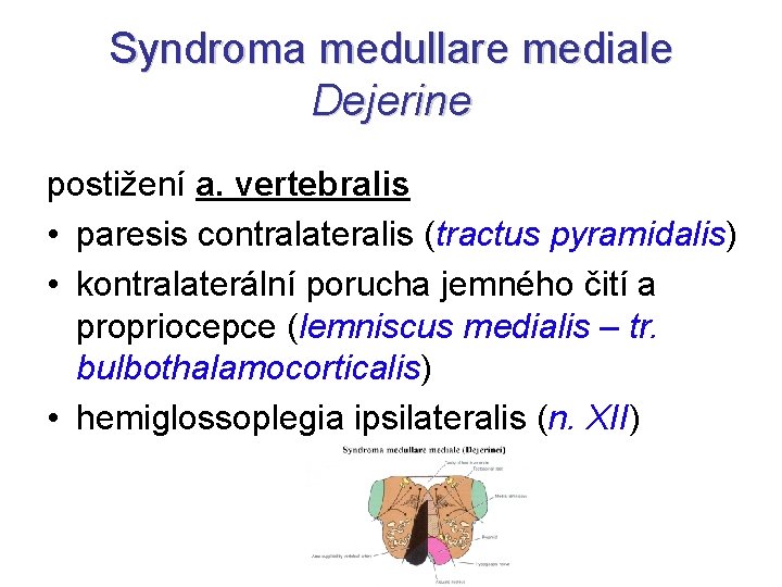 Syndroma medullare mediale Dejerine postižení a. vertebralis • paresis contralateralis (tractus pyramidalis) • kontralaterální