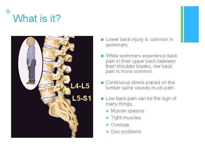 + What is it? n Lower back injury is common in swimmers. n While