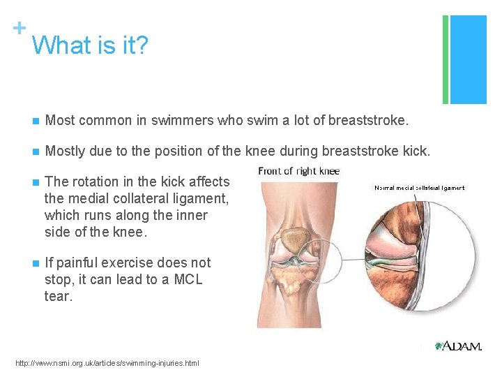 + What is it? n Most common in swimmers who swim a lot of