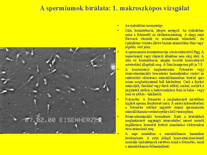 A spermiumok bírálata: 1. makroszkópos vizsgálat • • Az ejakulátum mennyisége. Szín, konzisztencia, idegen