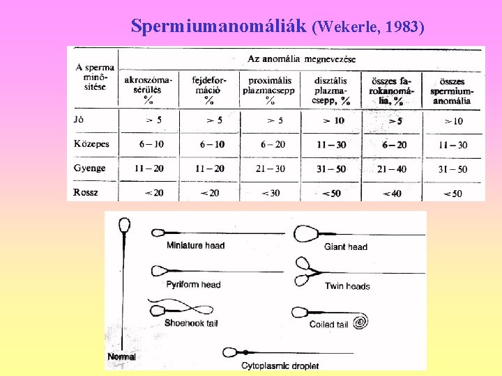Spermiumanomáliák (Wekerle, 1983) 