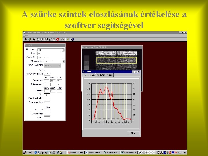 A szürke szintek eloszlásának értékelése a szoftver segítségével 