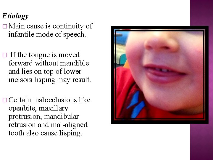 Etiology � Main cause is continuity of infantile mode of speech. � If the