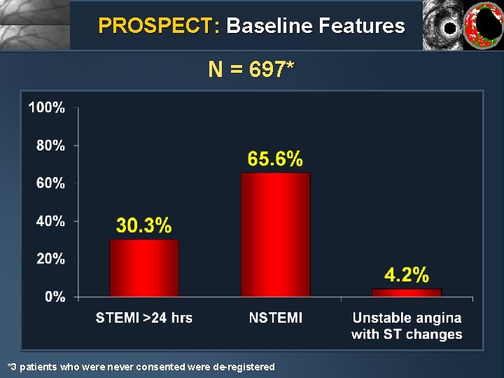 PROSPECT: Baseline Features N = 697* *3 patients who were never consented were de-registered