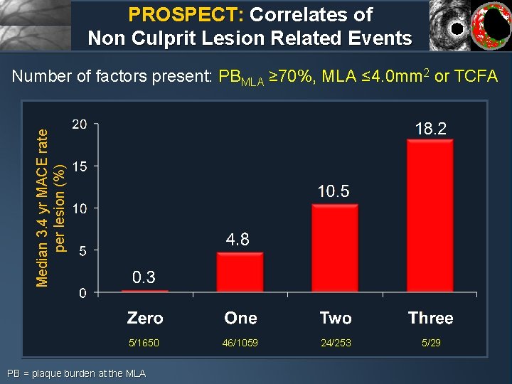 PROSPECT: Correlates of Non Culprit Lesion Related Events Median 3. 4 yr MACE rate