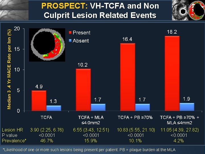PROSPECT: VH-TCFA and Non Culprit Lesion Related Events Lesion HR 3. 90 (2. 25,