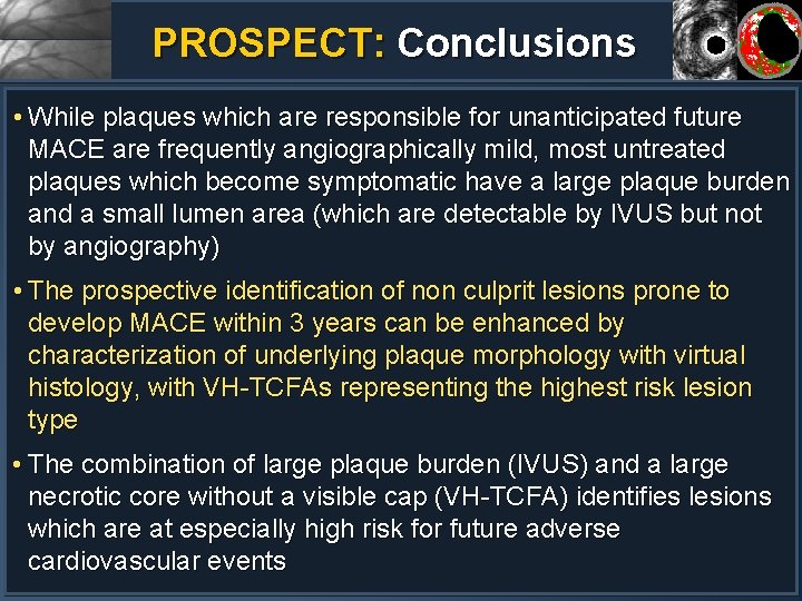 PROSPECT: Conclusions • While plaques which are responsible for unanticipated future MACE are frequently