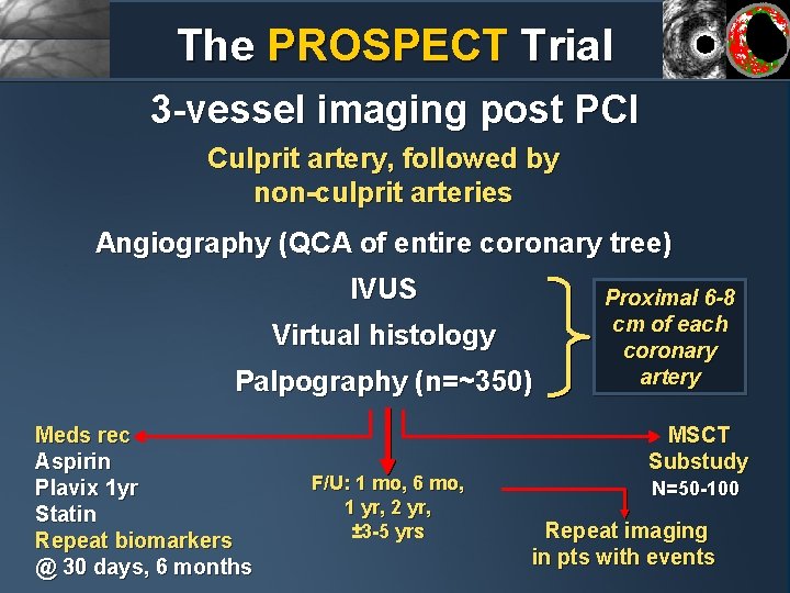 The PROSPECT Trial 3 -vessel imaging post PCI Culprit artery, followed by non-culprit arteries