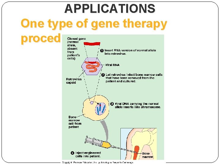 APPLICATIONS One type of gene therapy procedure 