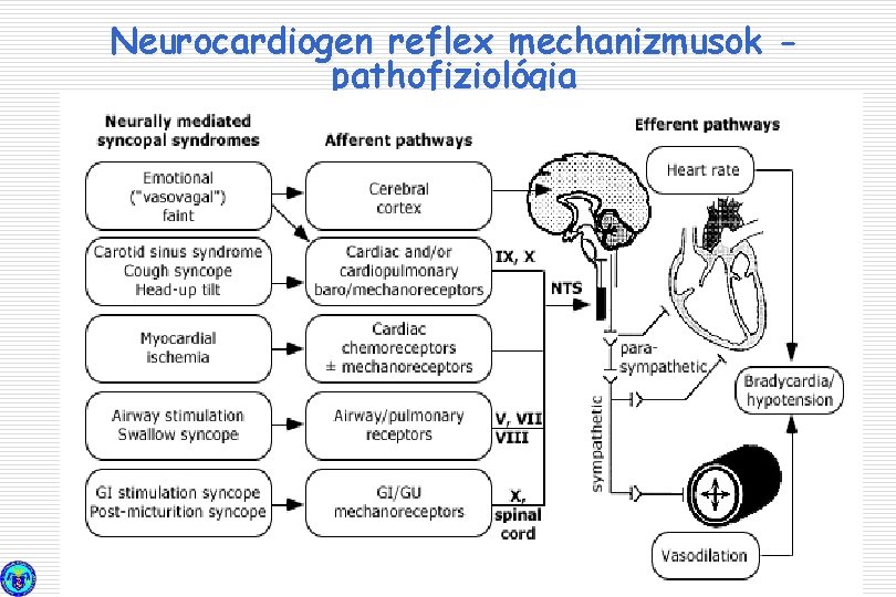 Neurocardiogen reflex mechanizmusok pathofiziológia 