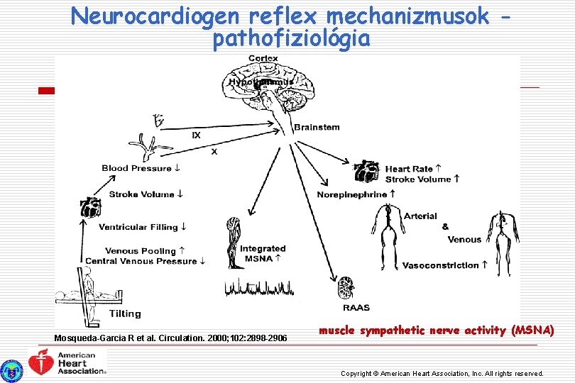 Neurocardiogen reflex mechanizmusok pathofiziológia Mosqueda-Garcia R et al. Circulation. 2000; 102: 2898 -2906 muscle