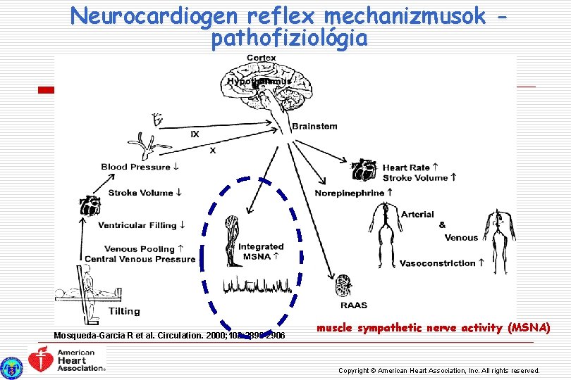 Neurocardiogen reflex mechanizmusok pathofiziológia Mosqueda-Garcia R et al. Circulation. 2000; 102: 2898 -2906 muscle