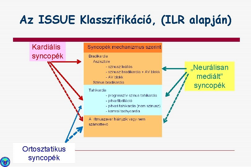 Az ISSUE Klasszifikáció, (ILR alapján) Kardiális syncopék „Neurálisan mediált” syncopék Ortosztatikus syncopék 