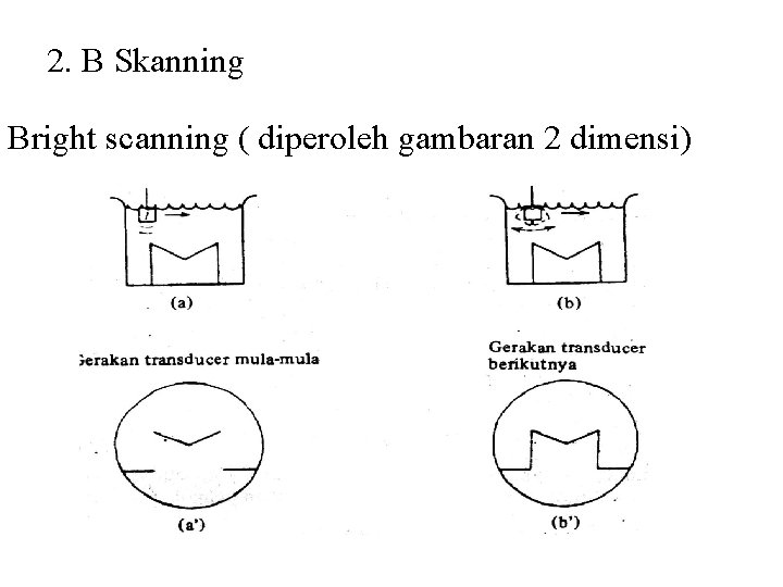 2. B Skanning Bright scanning ( diperoleh gambaran 2 dimensi) 