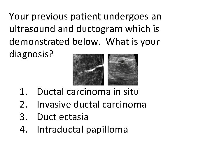 Your previous patient undergoes an ultrasound and ductogram which is demonstrated below. What is