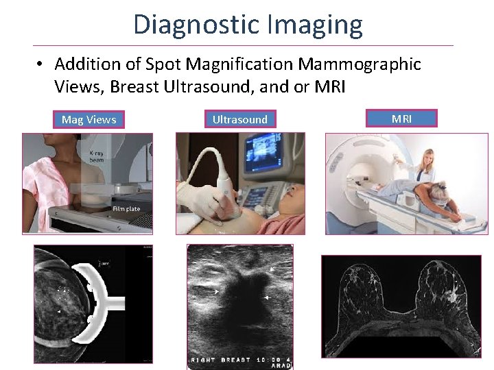 Diagnostic Imaging • Addition of Spot Magnification Mammographic Views, Breast Ultrasound, and or MRI