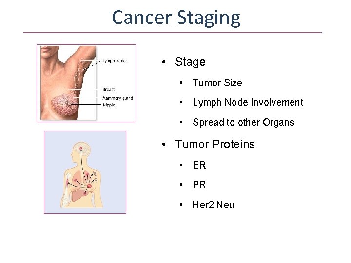 Cancer Staging • Stage • Tumor Size • Lymph Node Involvement • Spread to