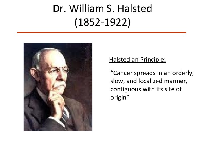 Dr. William S. Halsted (1852 -1922) Halstedian Principle: “Cancer spreads in an orderly, slow,