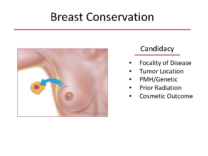 Breast Conservation Candidacy • • • Focality of Disease Tumor Location PMH/Genetic Prior Radiation