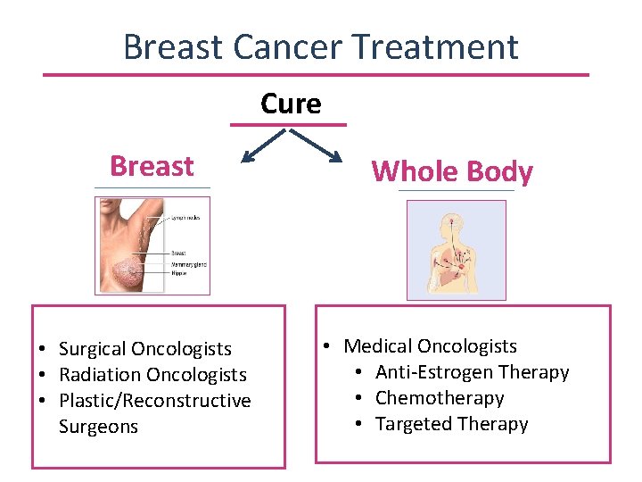 Breast Cancer Treatment Cure Breast Whole Body • Surgical Oncologists • Radiation Oncologists •