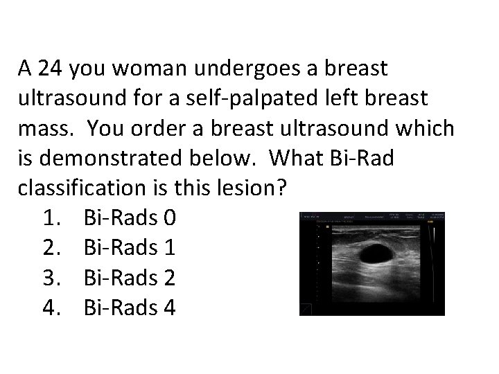 A 24 you woman undergoes a breast ultrasound for a self-palpated left breast mass.