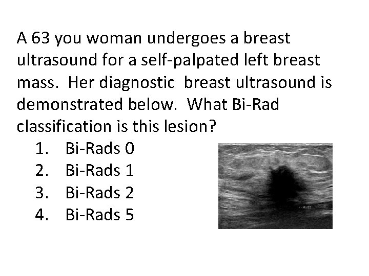 A 63 you woman undergoes a breast ultrasound for a self-palpated left breast mass.