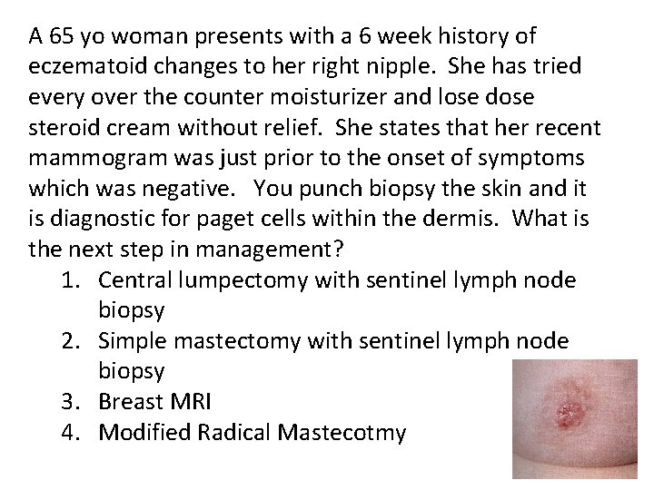 A 65 yo woman presents with a 6 week history of eczematoid changes to