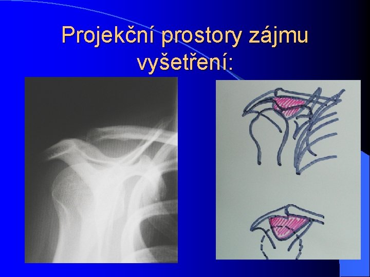 Projekční prostory zájmu vyšetření: 