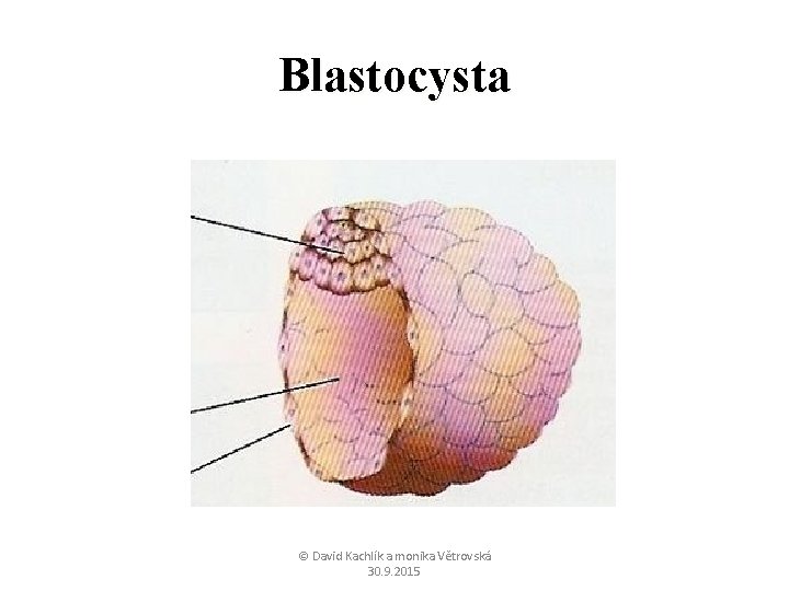 Blastocysta © David Kachlík a monika Větrovská 30. 9. 2015 