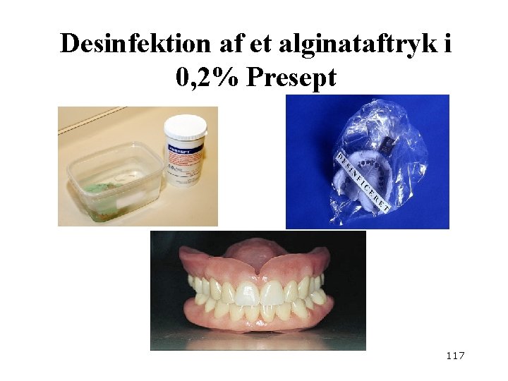 Desinfektion af et alginataftryk i 0, 2% Presept 117 