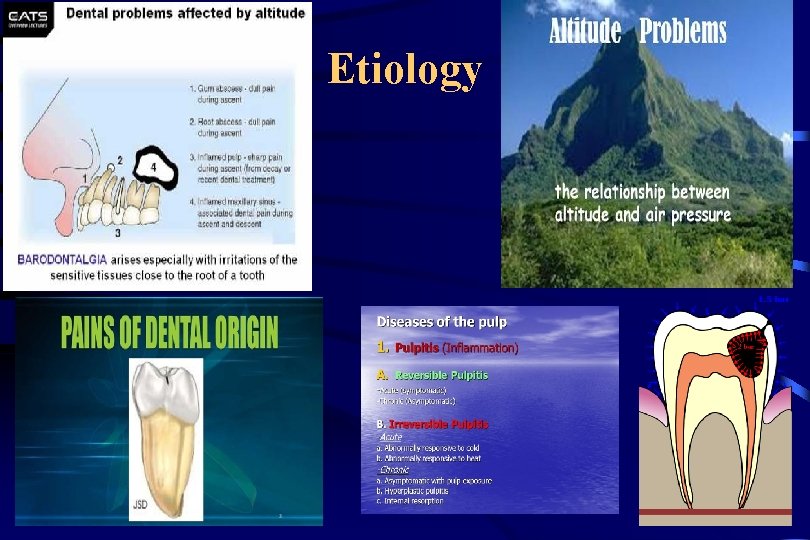 Etiology 