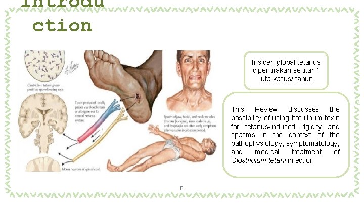 Introdu ction Insiden global tetanus diperkirakan sekitar 1 juta kasus/ tahun This Review discusses