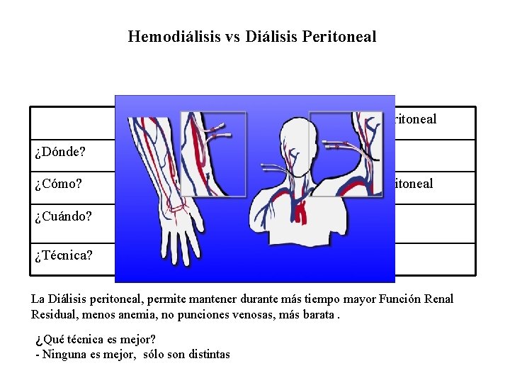 Hemodiálisis vs Diálisis Peritoneal Hemodiálisis Diálisis Peritoneal ¿Dónde? Hospital (domicilio) Domicilio ¿Cómo? Fístula/catéter Catéter