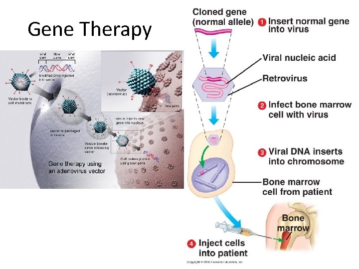 Gene Therapy 