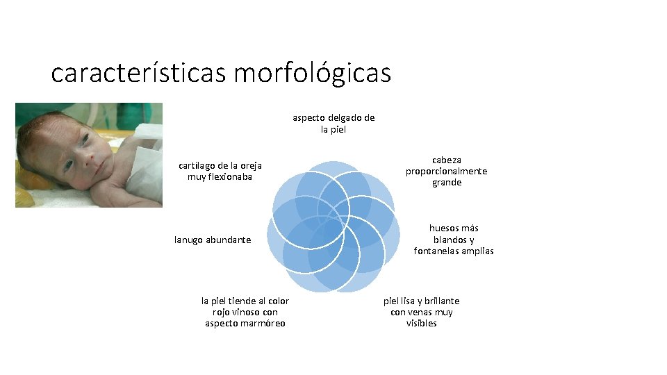características morfológicas aspecto delgado de la piel cartílago de la oreja muy flexionaba lanugo