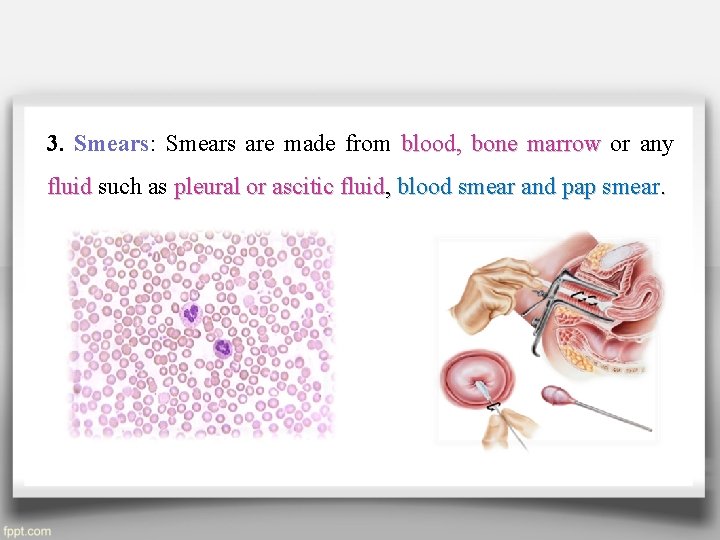 3. Smears: Smears are made from blood, bone marrow or any fluid such as