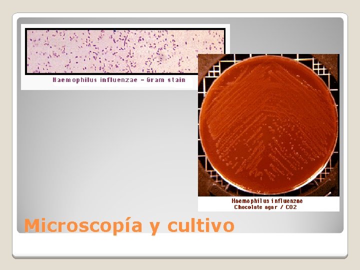 Microscopía y cultivo 