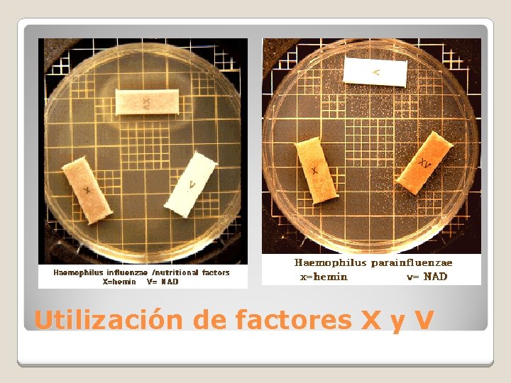 Utilización de factores X y V 