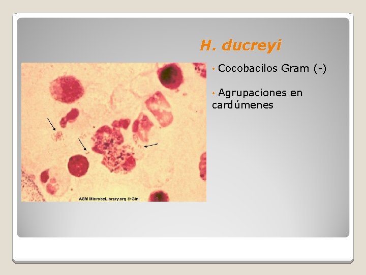 H. ducreyi • Cocobacilos Gram (-) • Agrupaciones en cardúmenes 