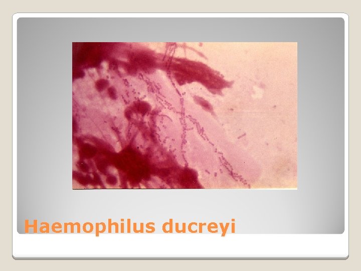 Haemophilus ducreyi 