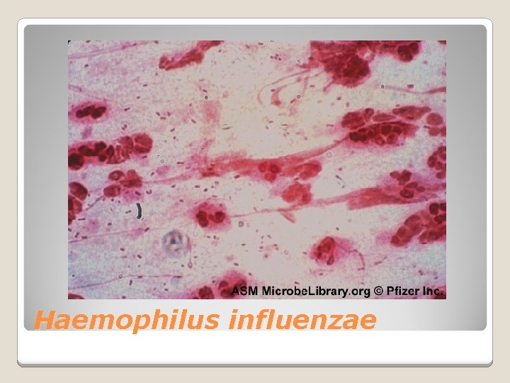 Haemophilus influenzae 