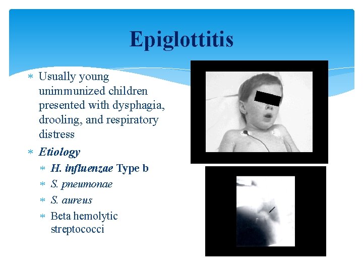 Epiglottitis Usually young unimmunized children presented with dysphagia, drooling, and respiratory distress Etiology H.