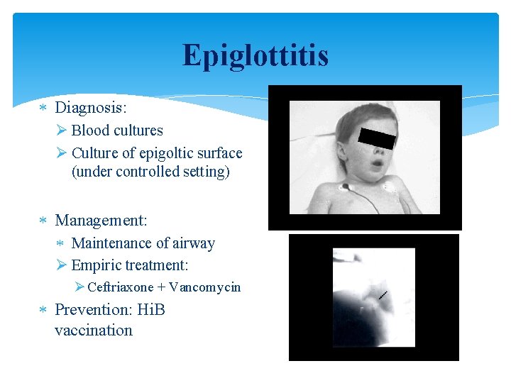 Epiglottitis Diagnosis: Ø Blood cultures Ø Culture of epigoltic surface (under controlled setting) Management: