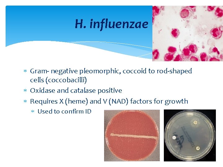 H. influenzae Gram negative pleomorphic, coccoid to rod shaped cells (coccobacilli) Oxidase and catalase