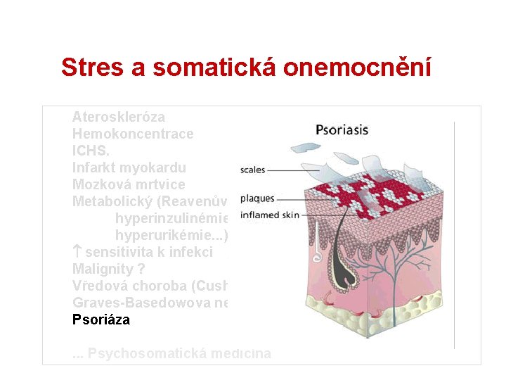 Stres a somatická onemocnění Ateroskleróza Hemokoncentrace ICHS. Infarkt myokardu Mozková mrtvice Metabolický (Reavenův) syndrom