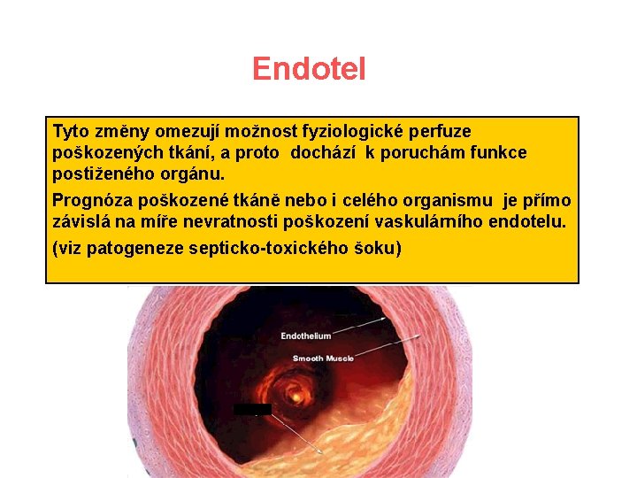 Endotel Tyto změny omezují možnost fyziologické perfuze poškozených tkání, a proto dochází k poruchám