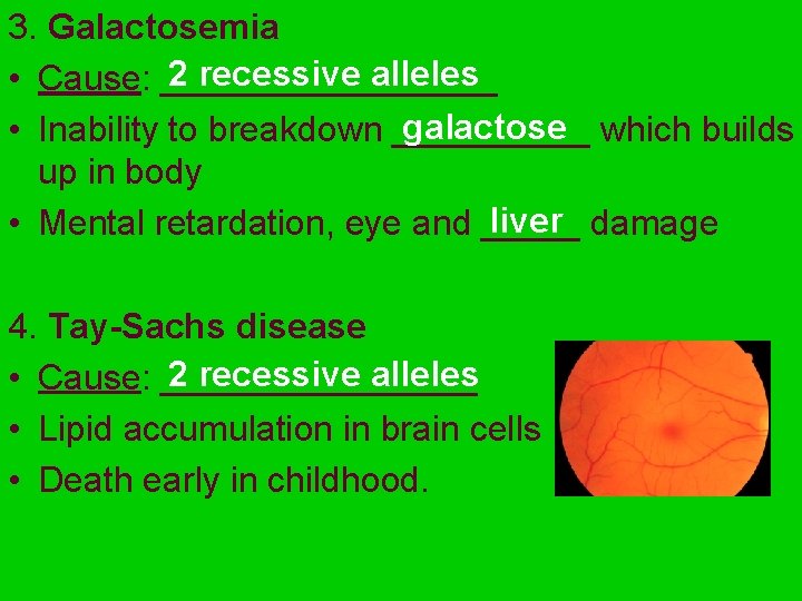 3. Galactosemia 2 recessive alleles • Cause: _________ galactose which builds • Inability to