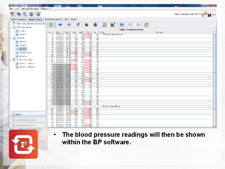  • The blood pressure readings will then be shown within the BP software.