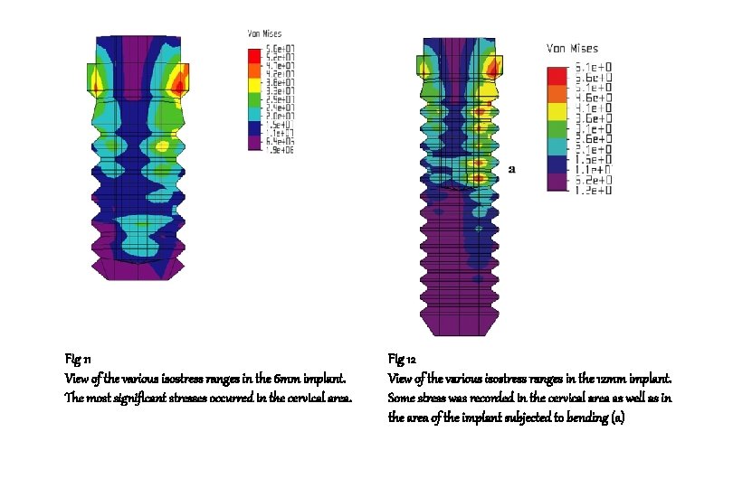 Fig 11 View of the various isostress ranges in the 6 mm implant. The