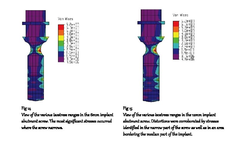 Fig 14 View of the various isostress ranges in the 6 mm implant abutment